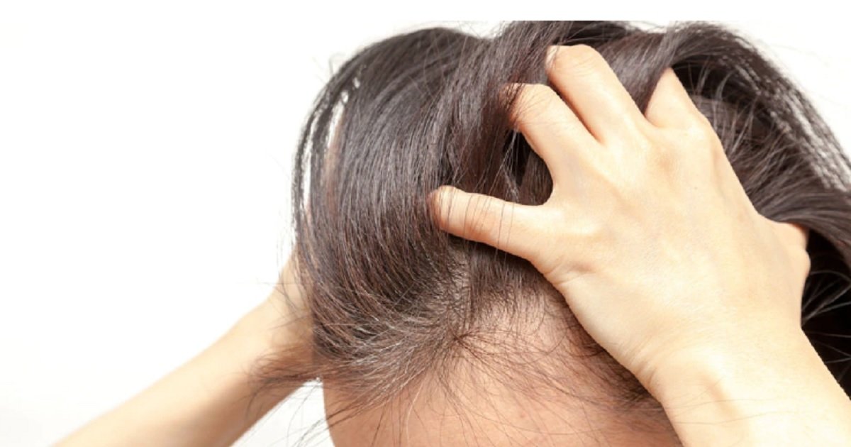 Review Rawatan Kulit Kepala "SoothingCare" oleh FollicaPro