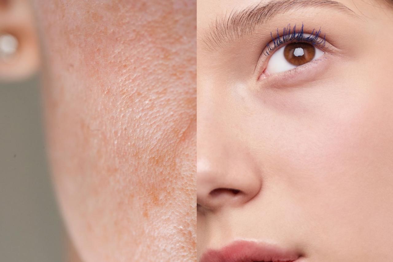 Facial Yang Mengubah Tekstur Kulit Mengikut Emosi